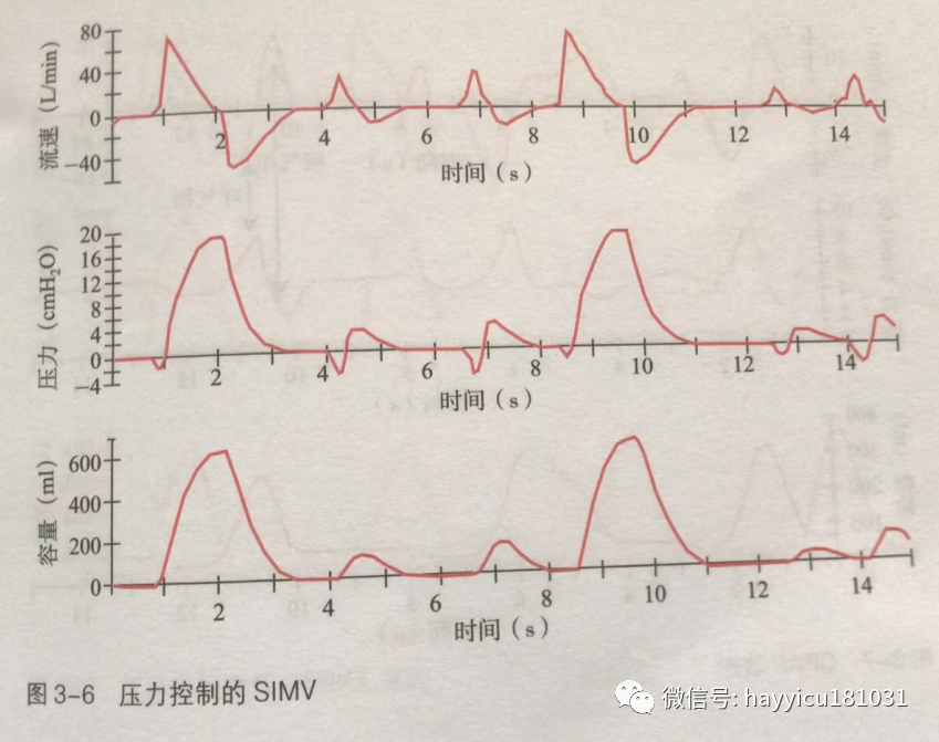 呼吸机怎么读卡各种通气模式波形汇总及其解读【收藏】_https://www.jmylbn.com_新闻资讯_第6张