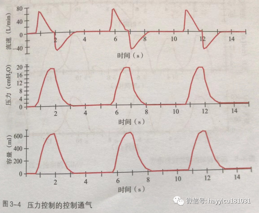 呼吸机怎么读卡各种通气模式波形汇总及其解读【收藏】_https://www.jmylbn.com_新闻资讯_第4张