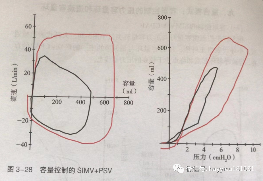 呼吸机怎么读卡各种通气模式波形汇总及其解读【收藏】_https://www.jmylbn.com_新闻资讯_第28张