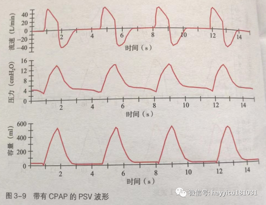 呼吸机怎么读卡各种通气模式波形汇总及其解读【收藏】_https://www.jmylbn.com_新闻资讯_第9张