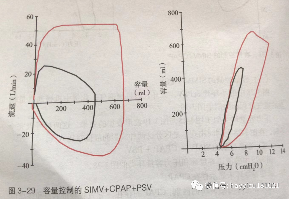 呼吸机怎么读卡各种通气模式波形汇总及其解读【收藏】_https://www.jmylbn.com_新闻资讯_第29张