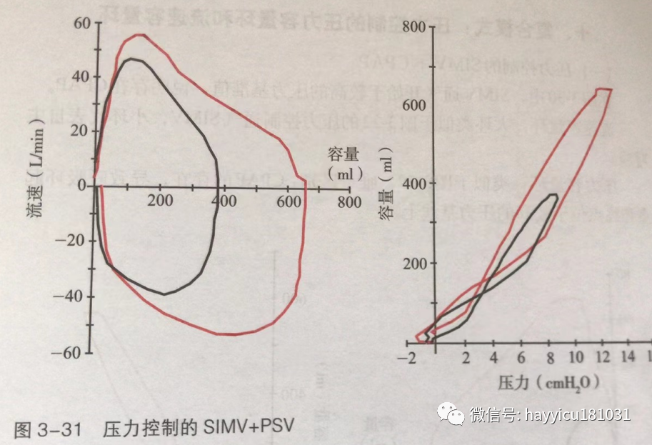 呼吸机怎么读卡各种通气模式波形汇总及其解读【收藏】_https://www.jmylbn.com_新闻资讯_第31张