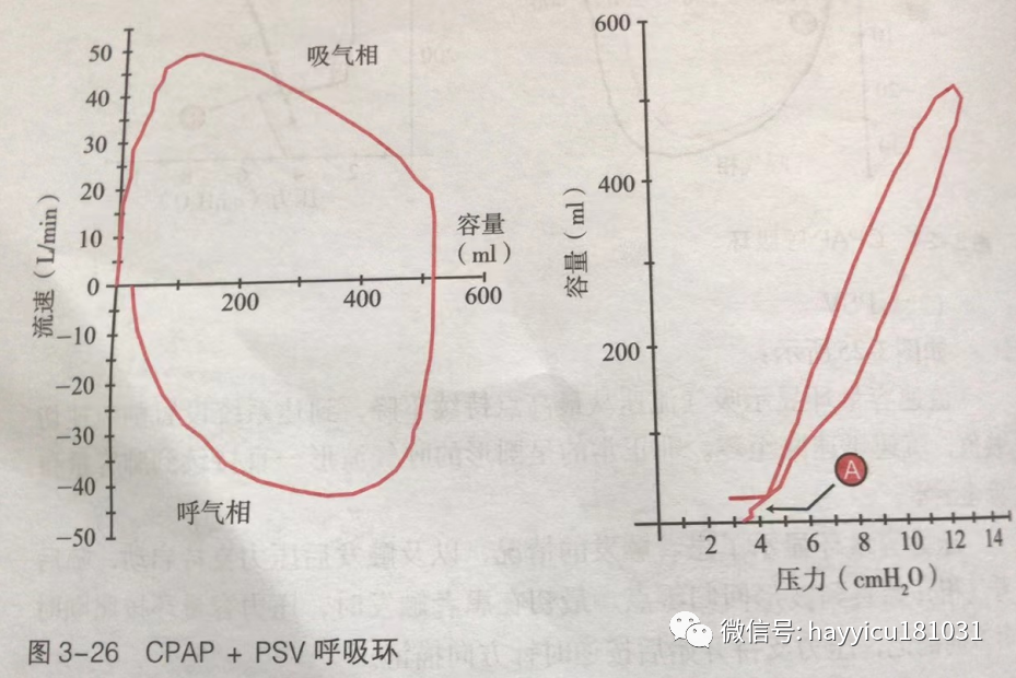 呼吸机怎么读卡各种通气模式波形汇总及其解读【收藏】_https://www.jmylbn.com_新闻资讯_第26张