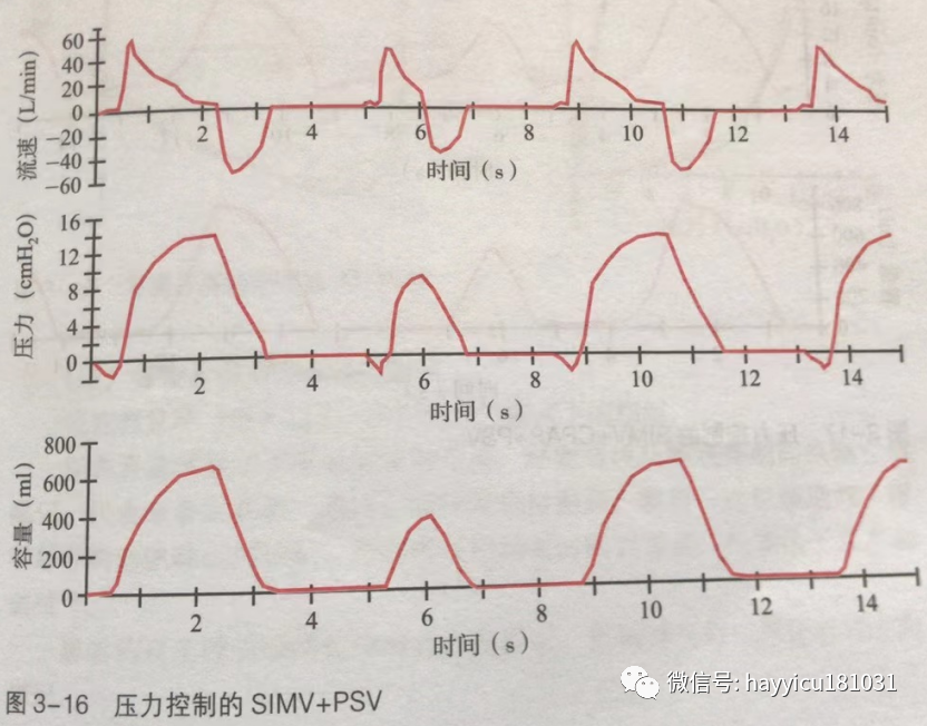 呼吸机怎么读卡各种通气模式波形汇总及其解读【收藏】_https://www.jmylbn.com_新闻资讯_第16张