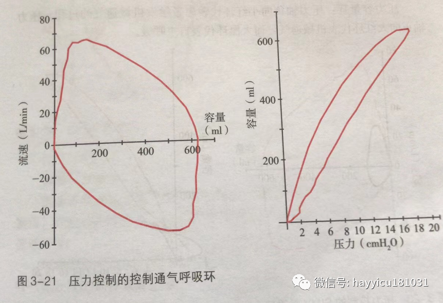 呼吸机怎么读卡各种通气模式波形汇总及其解读【收藏】_https://www.jmylbn.com_新闻资讯_第21张