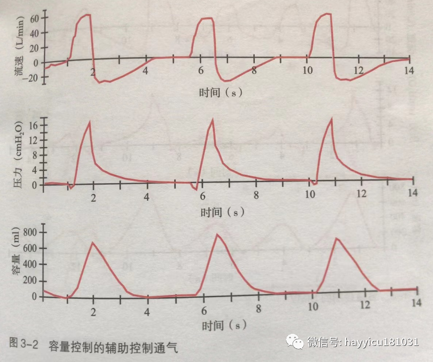 呼吸机怎么读卡各种通气模式波形汇总及其解读【收藏】_https://www.jmylbn.com_新闻资讯_第2张