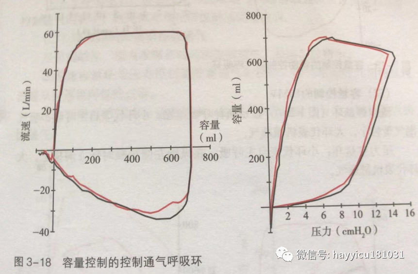 呼吸机怎么读卡各种通气模式波形汇总及其解读【收藏】_https://www.jmylbn.com_新闻资讯_第18张