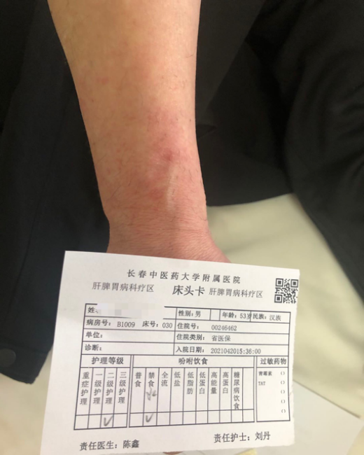 怎么贴好输液贴【名医名科】长期静脉输液的好搭档：水凝胶豆黄消炎贴_https://www.jmylbn.com_新闻资讯_第4张