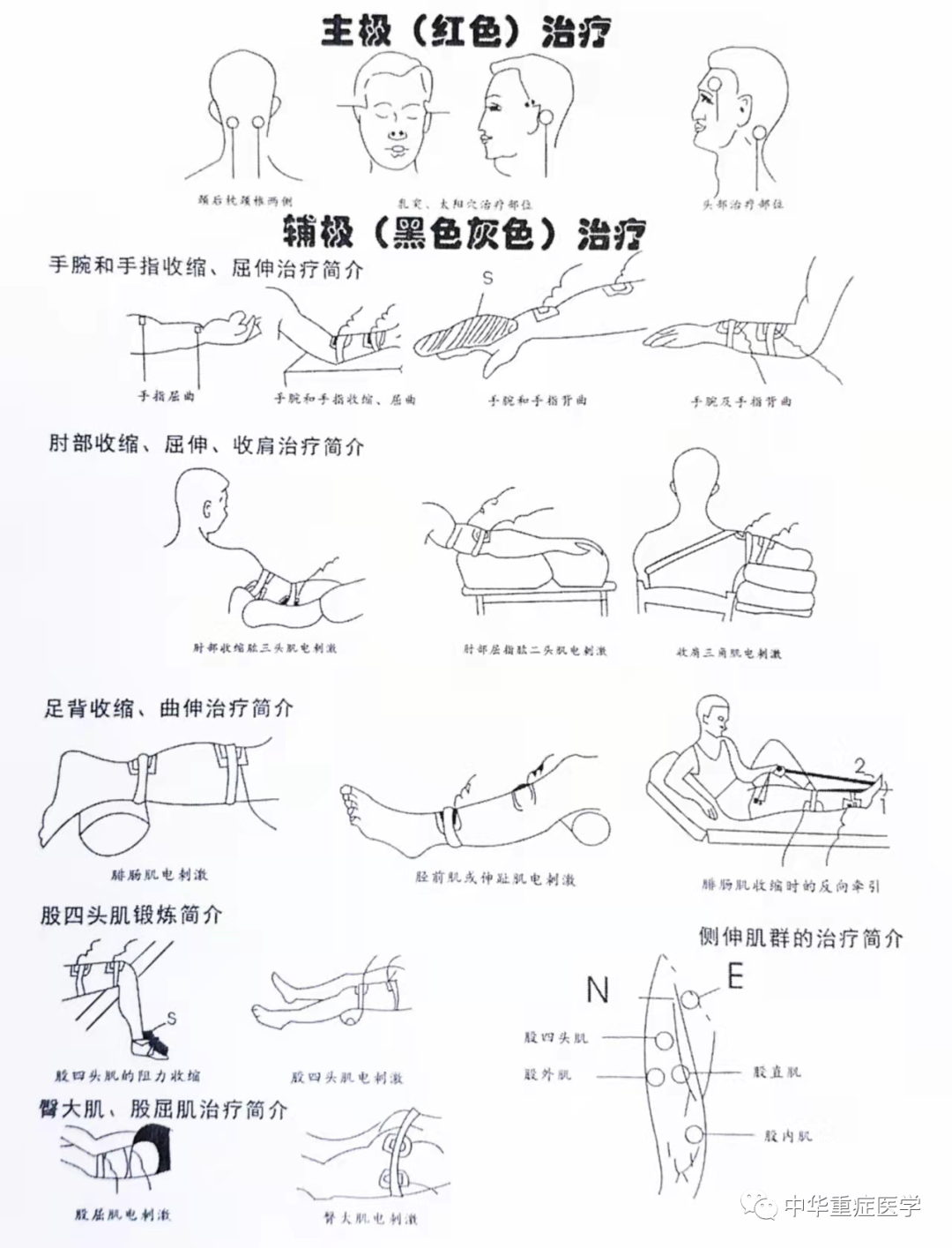 康复振动仪怎么使用重症康复器材——脑电仿生电刺激仪使用与维护_https://www.jmylbn.com_新闻资讯_第4张