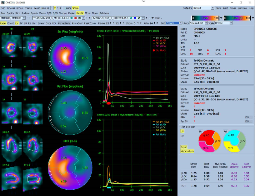 d-spect怎么检查D-SPECT与13N-氨水PET测量CFR最新研究结果在国际顶级期刊发表_https://www.jmylbn.com_新闻资讯_第5张