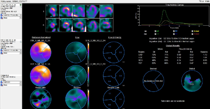 d-spect怎么检查D-SPECT与13N-氨水PET测量CFR最新研究结果在国际顶级期刊发表_https://www.jmylbn.com_新闻资讯_第4张