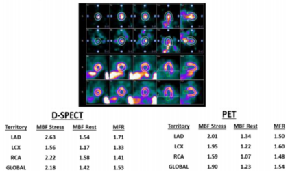 d-spect怎么检查D-SPECT与13N-氨水PET测量CFR最新研究结果在国际顶级期刊发表_https://www.jmylbn.com_新闻资讯_第6张