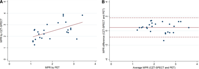 d-spect怎么检查D-SPECT与13N-氨水PET测量CFR最新研究结果在国际顶级期刊发表_https://www.jmylbn.com_新闻资讯_第10张