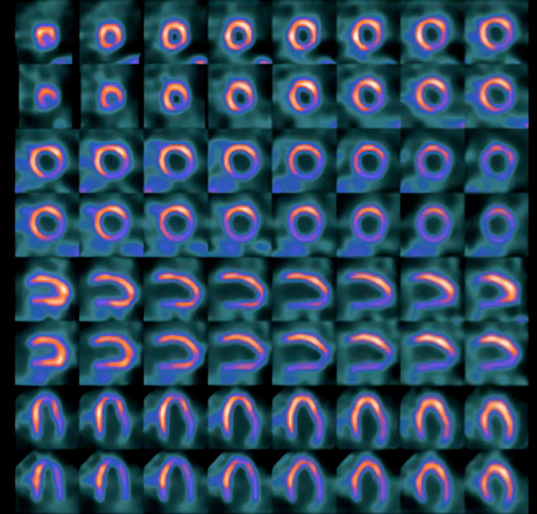 d-spect怎么检查关于D-SPECT的“十问十答”／／第二弹_https://www.jmylbn.com_新闻资讯_第3张