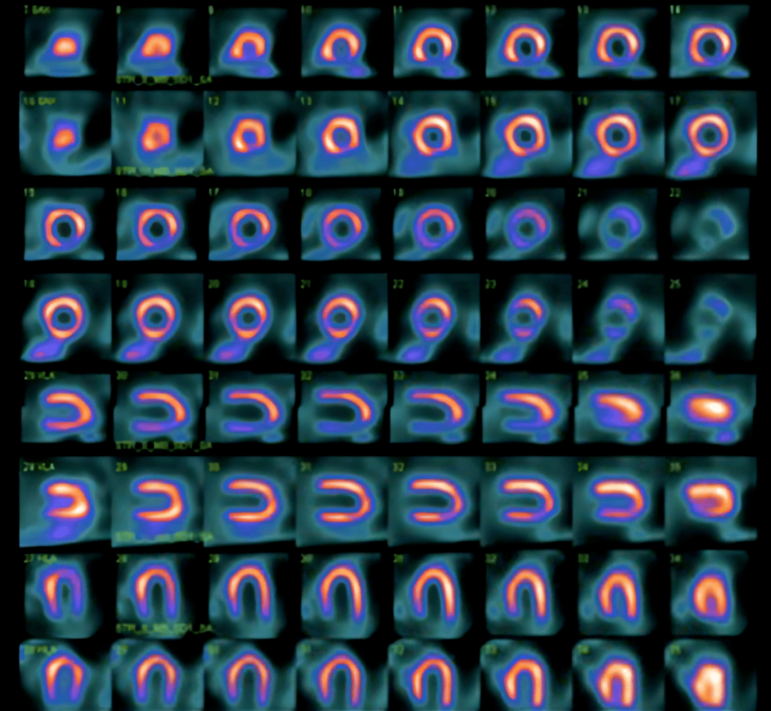 d-spect怎么检查关于D-SPECT的“十问十答”／／第二弹_https://www.jmylbn.com_新闻资讯_第2张