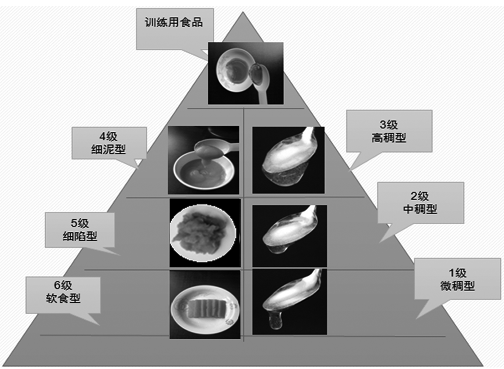 2019 版《吞咽障礙膳食營養管理中國專家共識》來啦！ | 指南共識 健康 第5張