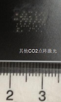 妇科脉冲怎么回事皮防科普 ｜ 妇科新宠——CO2酷密点阵治疗，解决你的“内”外兼修_https://www.jmylbn.com_新闻资讯_第12张