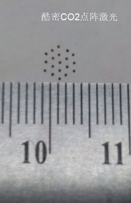 妇科脉冲怎么回事皮防科普 ｜ 妇科新宠——CO2酷密点阵治疗，解决你的“内”外兼修_https://www.jmylbn.com_新闻资讯_第13张