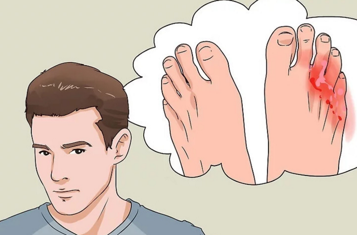 什么是vsd引流VSD负压引流技术 护好“糖腿”不截肢_https://www.jmylbn.com_新闻资讯_第5张