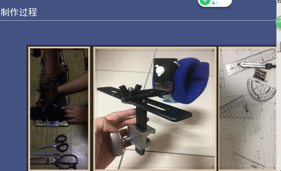 手术头皮夹怎么放护理创新的七个＂金点子＂，太实用了！看看我们可以借鉴不？_https://www.jmylbn.com_新闻资讯_第5张