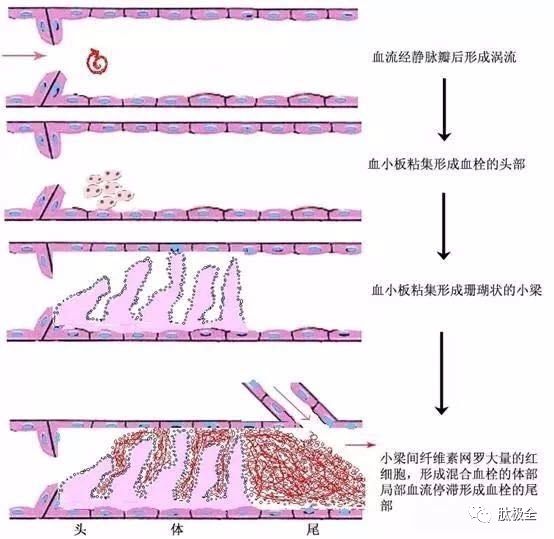 肽降低血液的粘稠度，改善脑血栓！