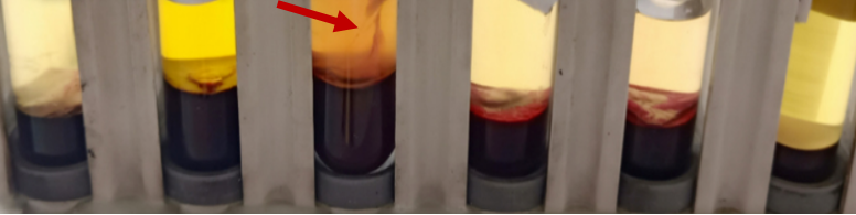 凝血四项用什么试剂还在为凝血四项APTT值偏低而疑惑？不妨看看这篇文章，你就懂了..._https://www.jmylbn.com_新闻资讯_第8张