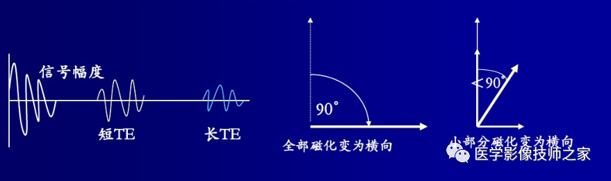 磁共振矩阵怎么计算作为一名合格的磁共振技师，你所必须熟知的技术参数_https://www.jmylbn.com_新闻资讯_第14张