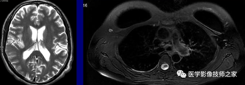 磁共振矩阵怎么计算作为一名合格的磁共振技师，你所必须熟知的技术参数_https://www.jmylbn.com_新闻资讯_第15张