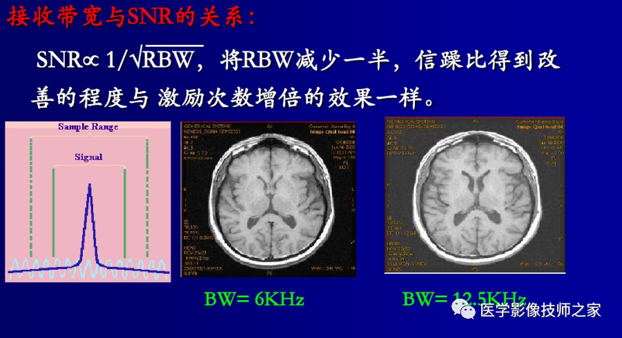 磁共振矩阵怎么计算作为一名合格的磁共振技师，你所必须熟知的技术参数_https://www.jmylbn.com_新闻资讯_第16张