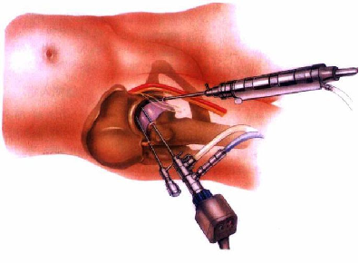关节镜配套哪些将膝关节“镜”行到底_https://www.jmylbn.com_新闻资讯_第6张