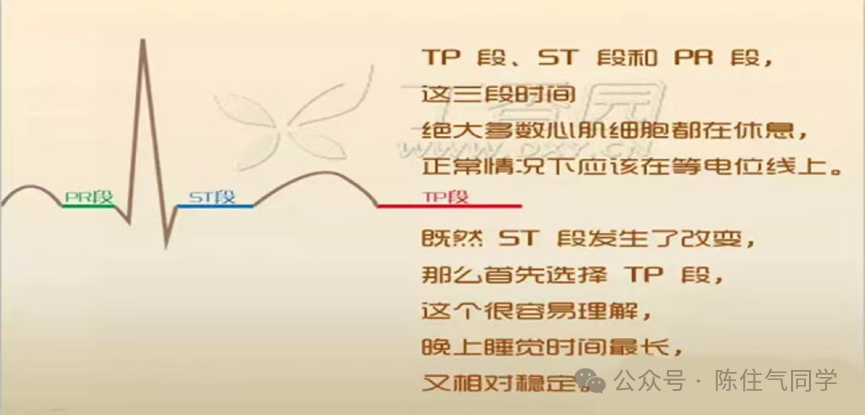 ST段抬高的识别及相关疾病的鉴别，这篇文章给你讲清楚了！