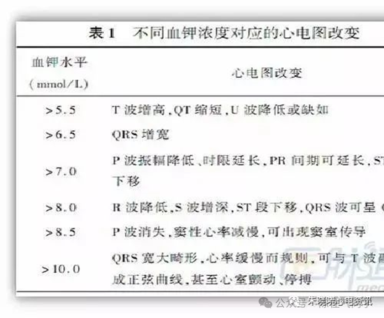 ST段抬高的识别及相关疾病的鉴别，这篇文章给你讲清楚了！