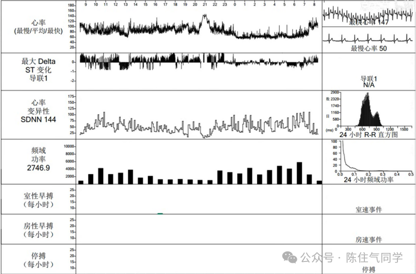 动态心电图怎么分析动态心电图的规范化分析和诊断_https://www.jmylbn.com_新闻资讯_第14张