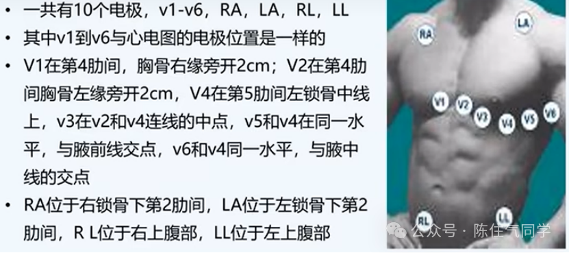 动态心电图怎么分析动态心电图的规范化分析和诊断_https://www.jmylbn.com_新闻资讯_第2张