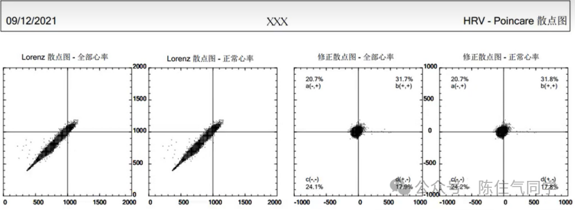 动态心电图怎么分析动态心电图的规范化分析和诊断_https://www.jmylbn.com_新闻资讯_第21张