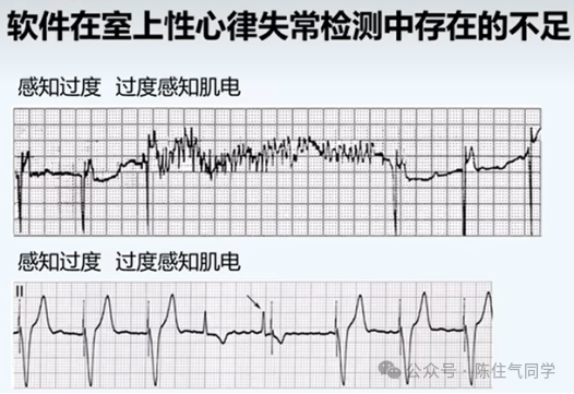 动态心电图怎么分析动态心电图的规范化分析和诊断_https://www.jmylbn.com_新闻资讯_第3张