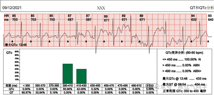 动态心电图怎么分析动态心电图的规范化分析和诊断_https://www.jmylbn.com_新闻资讯_第18张