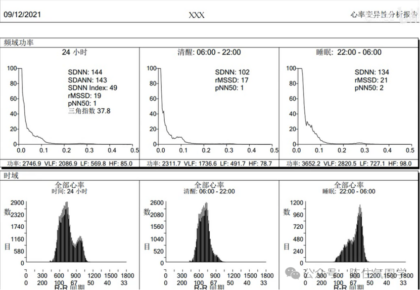 动态心电图怎么分析动态心电图的规范化分析和诊断_https://www.jmylbn.com_新闻资讯_第19张