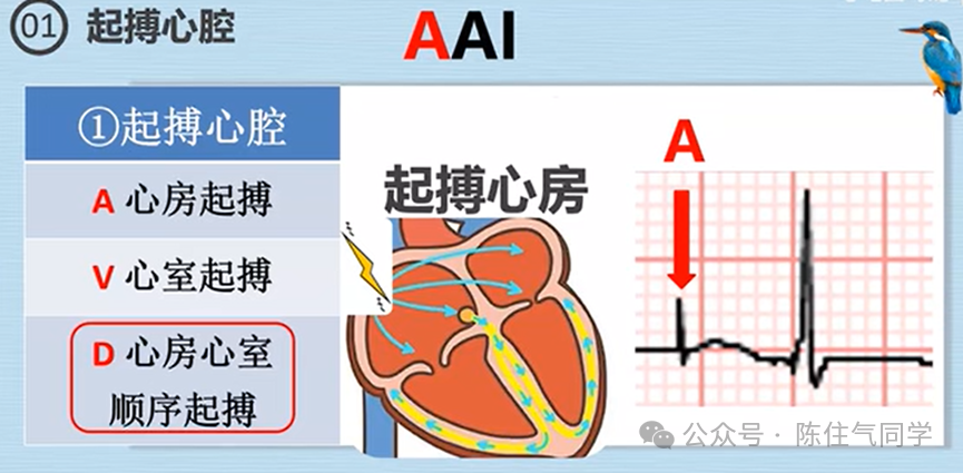 心电图器怎么用起搏器入门，简单易懂！_https://www.jmylbn.com_新闻资讯_第28张