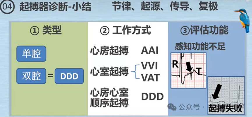 心电图器怎么用起搏器入门，简单易懂！_https://www.jmylbn.com_新闻资讯_第51张