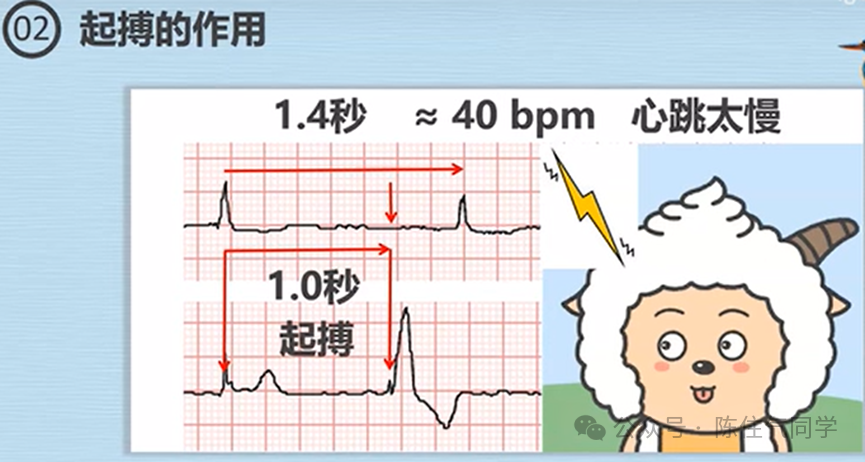 心电图器怎么用起搏器入门，简单易懂！_https://www.jmylbn.com_新闻资讯_第6张