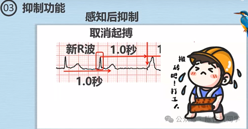 心电图器怎么用起搏器入门，简单易懂！_https://www.jmylbn.com_新闻资讯_第8张