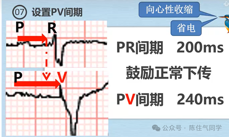 心电图器怎么用起搏器入门，简单易懂！_https://www.jmylbn.com_新闻资讯_第23张