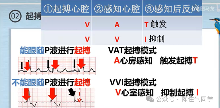 心电图器怎么用起搏器入门，简单易懂！_https://www.jmylbn.com_新闻资讯_第47张