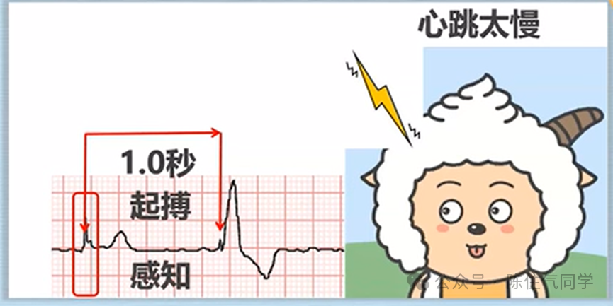 心电图器怎么用起搏器入门，简单易懂！_https://www.jmylbn.com_新闻资讯_第7张