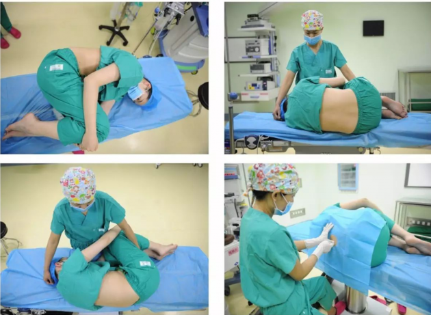 妇科手术床怎么座盘点妇产科手术需要“凹”的造型、“摆”的pose_https://www.jmylbn.com_新闻资讯_第5张