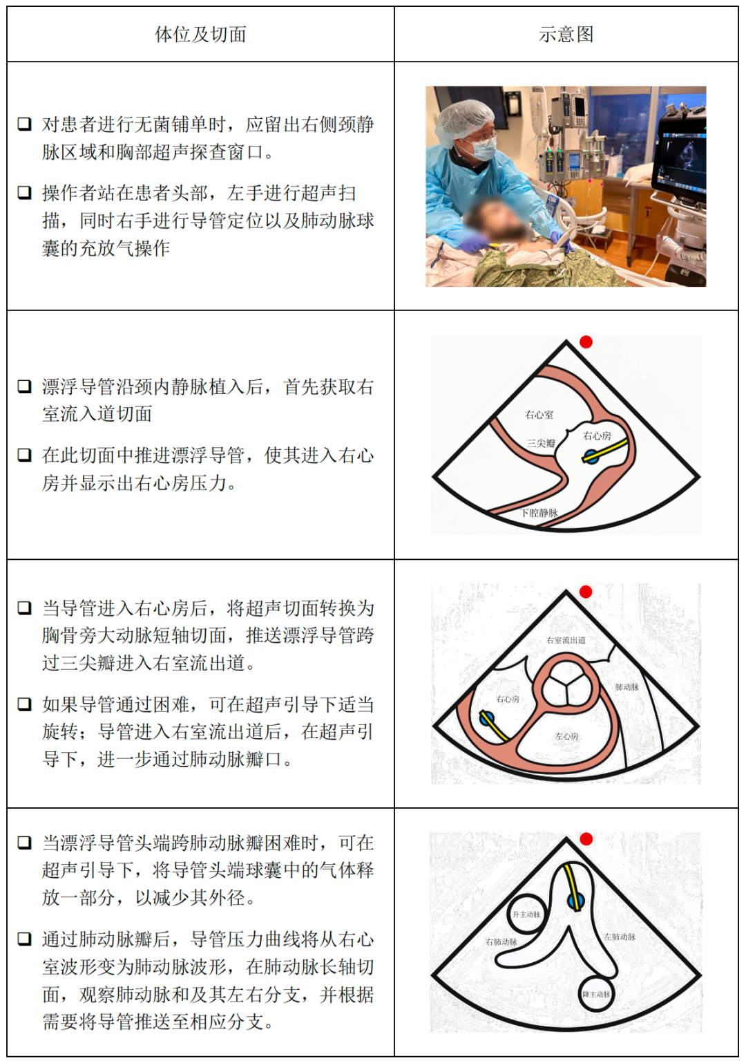 肺动脉高压超声评估简易流程
