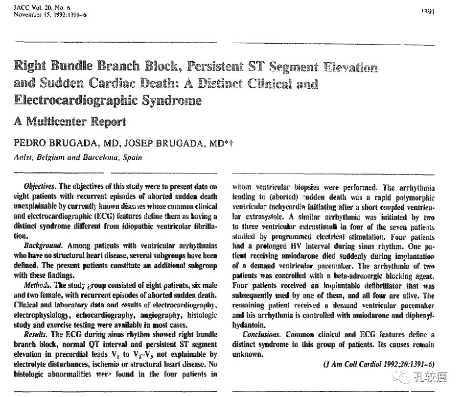10分钟掌握Brugada综合征