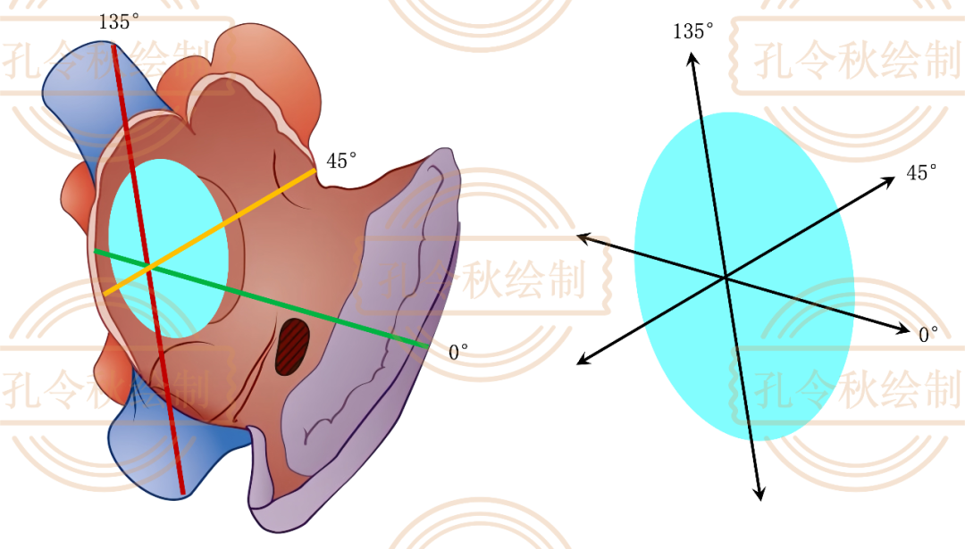 房间隔缺损大小，到底如何测量？