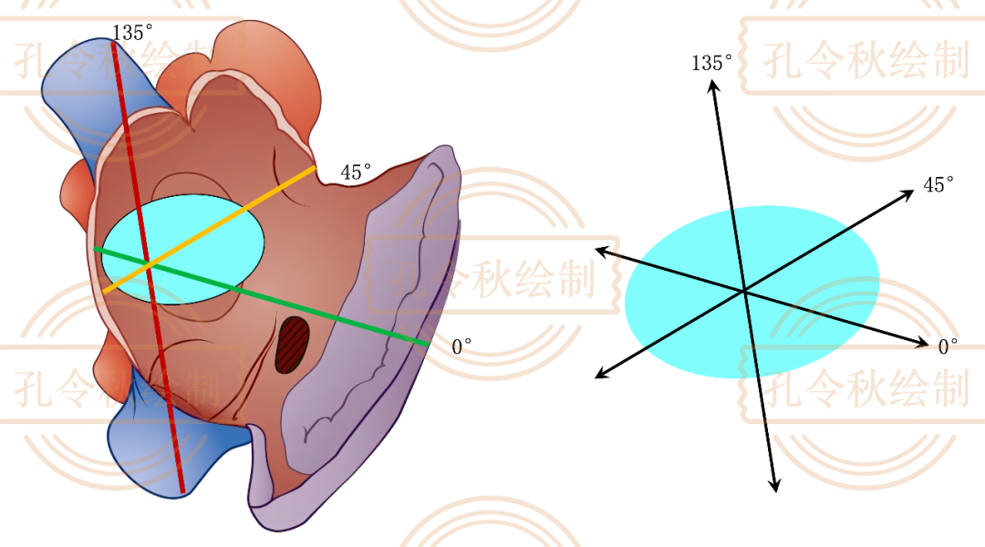 房间隔缺损大小，到底如何测量？